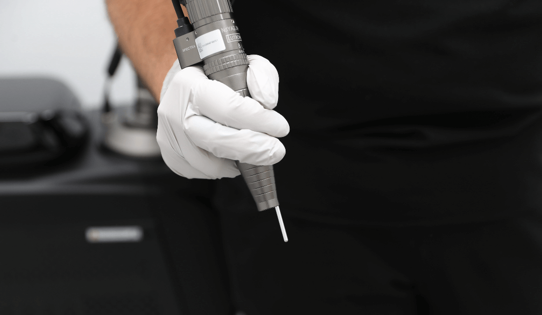 Why is Professional Tattoo Removal Safer than DIY Methods?