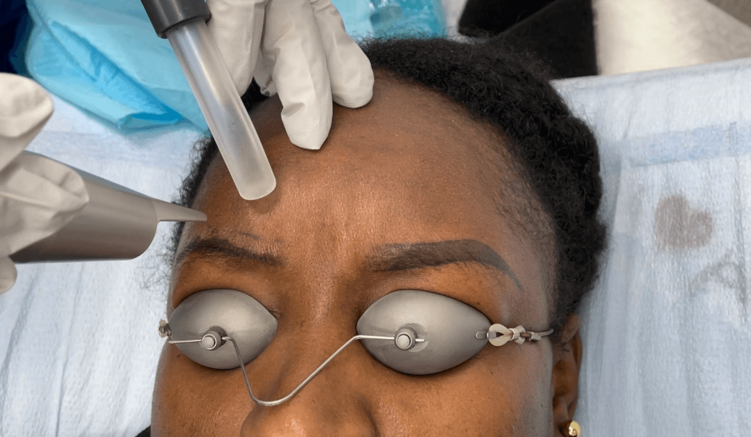 Cosmetic Tattoo Removal: A Closer Look at the Process and Results