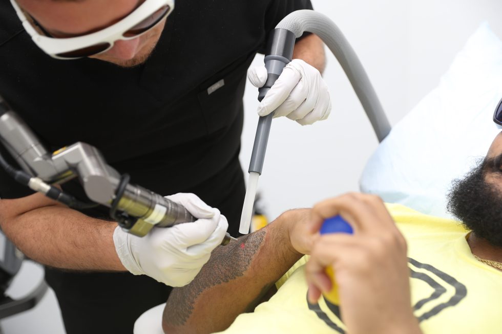 Pico Laser Tattoo Removal vs. Accelerated Removal Technique